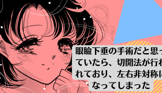 眼瞼下垂の手術だと思っていたら、切開法が行われており、左右非対称になってしまった