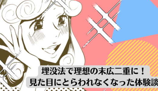 埋没法で理想の末広二重になりました！見た目にとらわれなくなった体験談